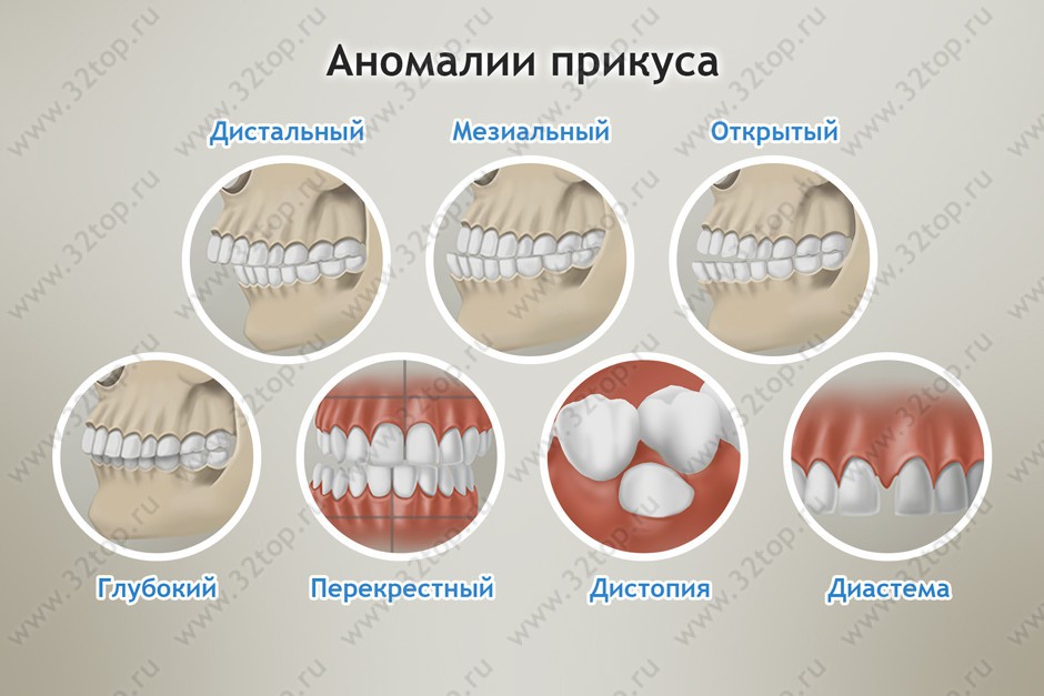 Внчс и шейный отдел позвоночника